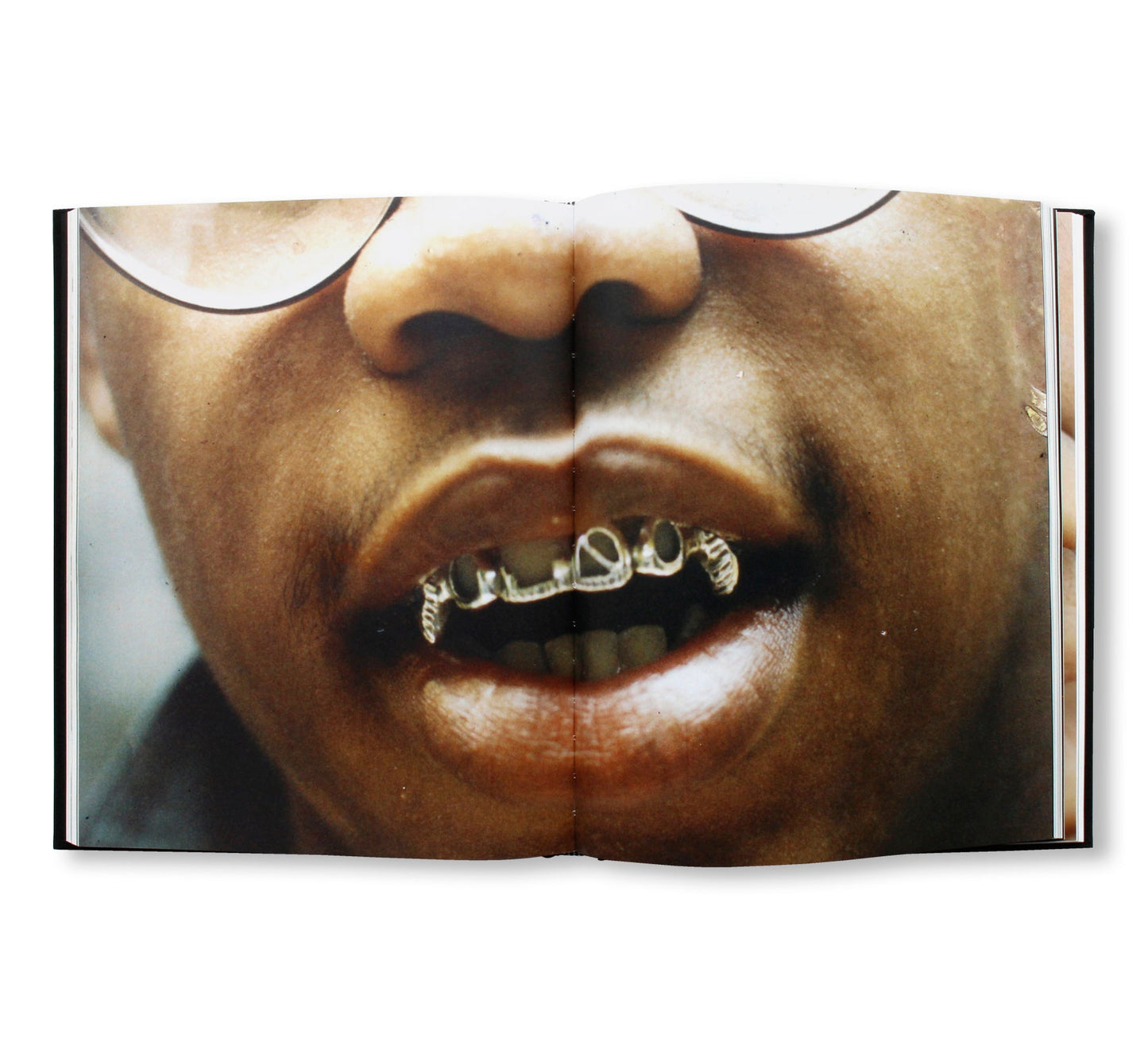 MOUTH FULL OF GOLDS