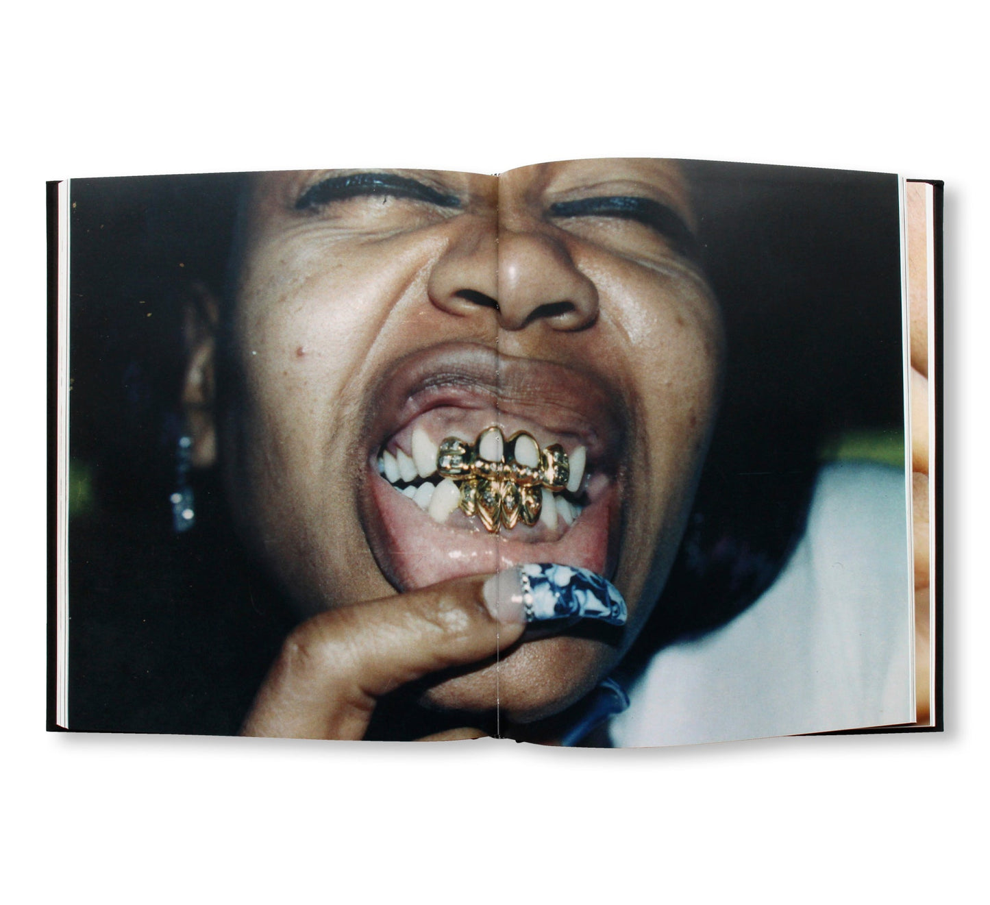MOUTH FULL OF GOLDS
