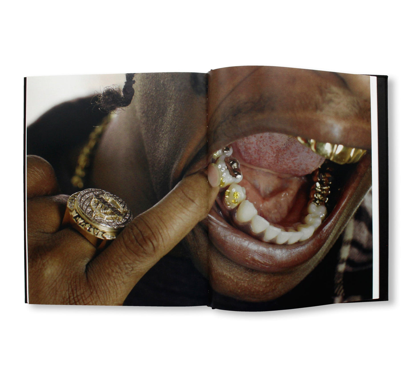 MOUTH FULL OF GOLDS