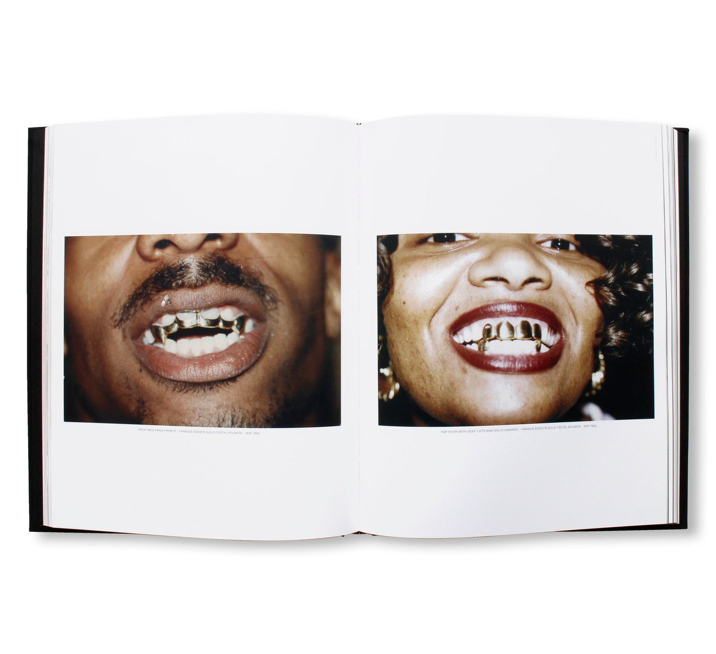 MOUTH FULL OF GOLDS