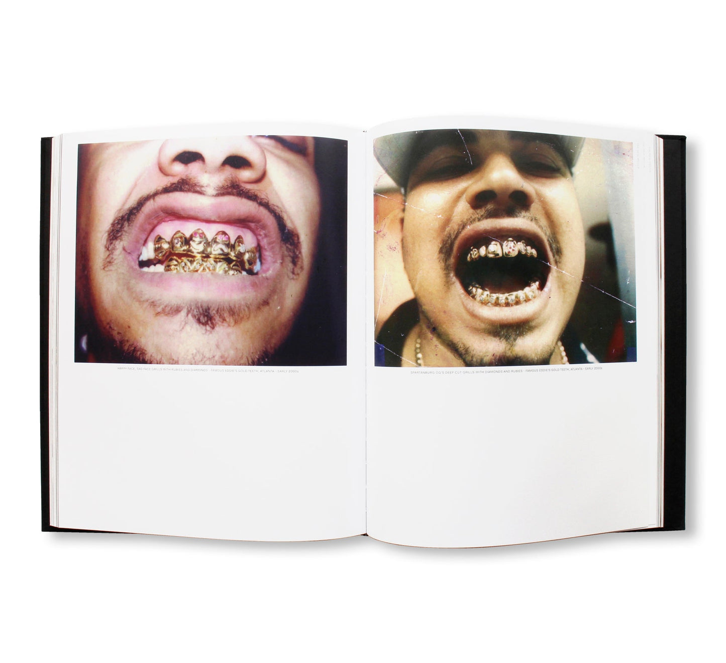 MOUTH FULL OF GOLDS